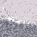 Immunohistochemical staining of human cerebellum shows moderate nuclear positivity in Purkinje cells, as well as in neurons in molecular layer.