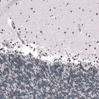Immunohistochemical staining of human cerebellum shows moderate nuclear positivity in Purkinje cells, as well as in neurons in molecular layer.