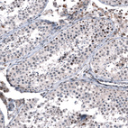 Immunohistochemical staining of human testis shows moderate to strong nuclear positivity in a subset of cells in seminiferous ducts.