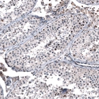 Immunohistochemical staining of human testis shows moderate to strong nuclear positivity in a subset of cells in seminiferous ducts.