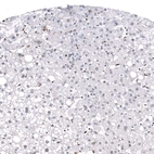 Immunohistochemical staining of human liver shows no positivity in hepatocytes as expected.