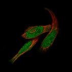 Immunofluorescence staining of RH-30 cells using the Anti-GLI1 monoclonal antibody, showing specific staining in the nucleoplasm and cytosol in green. Microtubule- and nuclear probes are visualized in red and blue, respectively (where available).