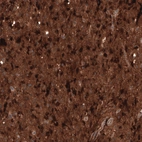 Anti-CHI3L1 Antibody