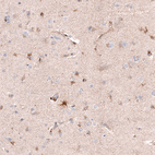 Immunohistochemical staining of human cerebral cortex shows moderate granular cytoplasmic positivity in glial cells.