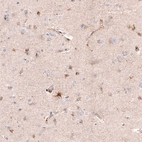 Immunohistochemical staining of human cerebral cortex shows moderate granular cytoplasmic positivity in glial cells.