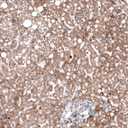 Immunohistochemical staining of human liver shows moderate granular cytoplasmic positivity in hepatocytes.