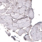 Immunohistochemical staining of human skeletal muscle shows no positivity in myocytes as expected.