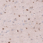 Immunohistochemical staining of human cerebral cortex shows moderate to strong cytoplasmic positivity in glial cells.