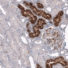 Immunohistochemical staining of human kidney shows strong granular cytoplasmic positivity in cells in tubules.