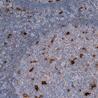 Anti-CHI3L1 Antibody