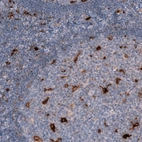 Immunohistochemical staining of human tonsil shows strong cytoplasmic positivity in a subset of lymphoid cells.