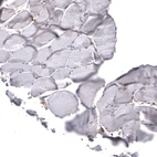 Immunohistochemical staining of human skeletal muscle shows no positivity in myocytes as expected.
