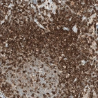 Immunohistochemical staining of human lymph node shows strong membranous positivity in germinal non-germinal center cells.