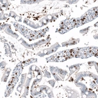 Immunohistochemical staining of human small intestine shows strong membranous positivity in lymphoid cells.