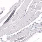 Immunohistochemical staining of human skeletal muscle shows no positivity in myocytes as expected.