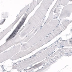 Immunohistochemical staining of human skeletal muscle shows no positivity in myocytes as expected.