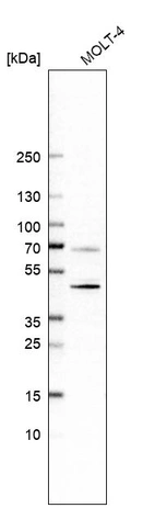 Western blot analysis in human cell line MOLT-4.