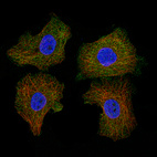 Anti-CD5 Antibody