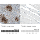 Anti-FCER2 Antibody