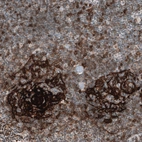 Immunohistochemical staining of human chronic lymphocytic leukemia shows strong membranous positivity in germinal center cells.