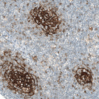 Anti-FCER2 Antibody