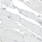 Immunohistochemical staining of human skeletal muscle shows no positivity in myocytes as expected.