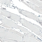 Immunohistochemical staining of human skeletal muscle shows no positivity in myocytes as expected.