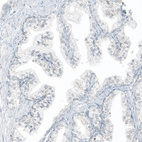 Anti-FCER2 Antibody