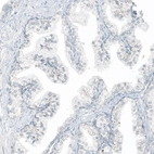 Immunohistochemical staining of human prostate shows no positivity in glandular cells as expected.