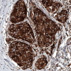 Anti-GSPT1 Antibody