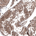 Immunohistochemical staining of human testis shows moderate to strong cytoplasmic positivity in cells in seminiferous ducts.