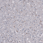 Immunohistochemical staining of human liver shows no positivity in hepatocytes.