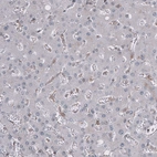 Immunohistochemical staining of human liver shows no positivity in hepatocytes.