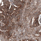 Anti-GSPT1 Antibody