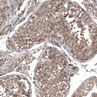 Immunohistochemical staining of human testis shows moderate cytoplasmic positivity in cells in seminiferous ducts.