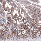 Anti-GSPT1 Antibody