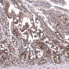 Immunohistochemical staining of human duodenum shows moderate cytoplasmic positivity in glandular cells.
