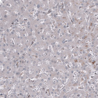 Anti-GSPT1 Antibody