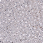 Immunohistochemical staining of human liver shows no positivity in hepatocytes.