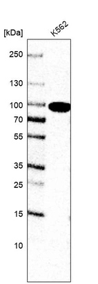 Western blot analysis in human cell line K562.