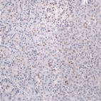 Immunohistochemical staining of human pancreas shows weak to moderate nuclear positivity in exocrine glandular cells.