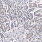 Anti-PROX1 Antibody