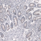 Immunohistochemical staining of human duodenum shows moderate nuclear positivity in a subset of glandular cells.