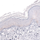 Anti-PROX1 Antibody