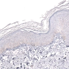 Immunohistochemical staining of human skin shows no positivity in squamous epithelial cells as expected.