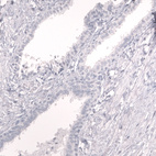 Anti-PROX1 Antibody