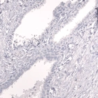 Immunohistochemical staining of human prostate shows no positivity in glandular cells as expected.