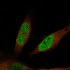 Anti-PROX1 Antibody