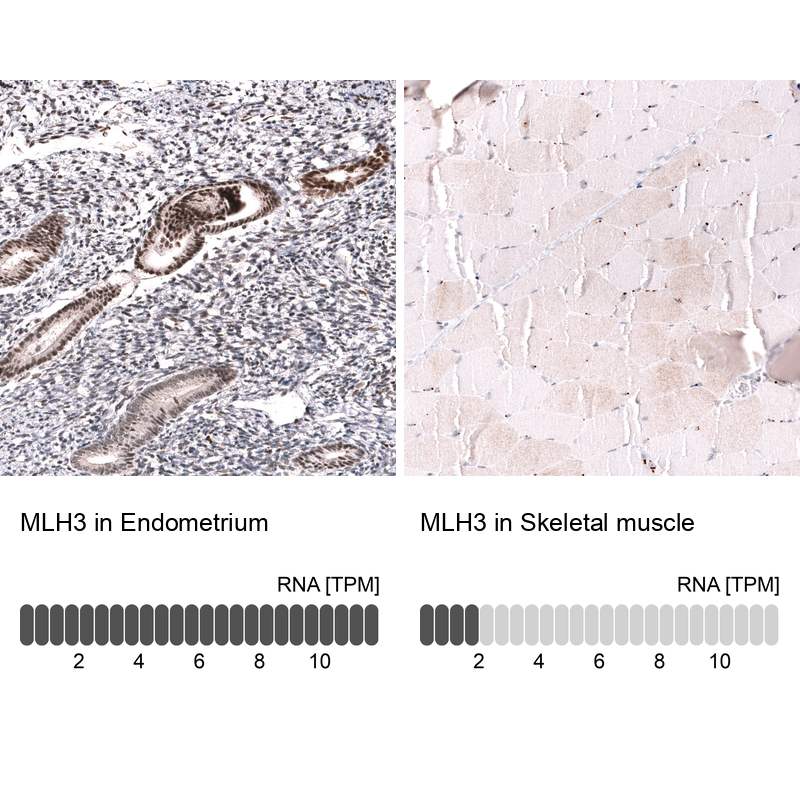 Anti-MLH3 Antibody