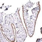 Immunohistochemical staining of human fallopian tube shows moderate nuclear positivity in glandular cells.